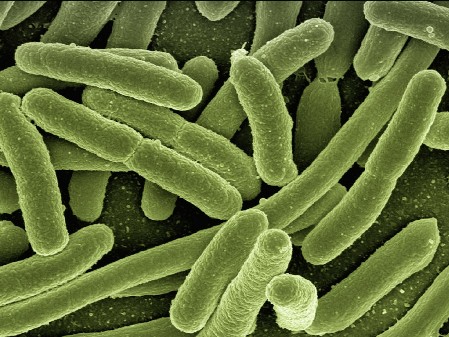 analisi microboilogiche microbiologia, legionella